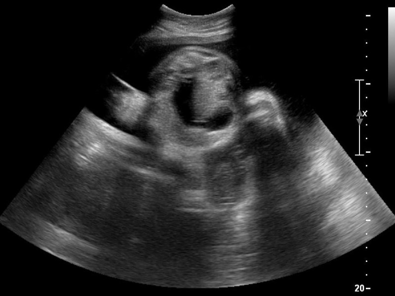 How to optimize your ultrasound image