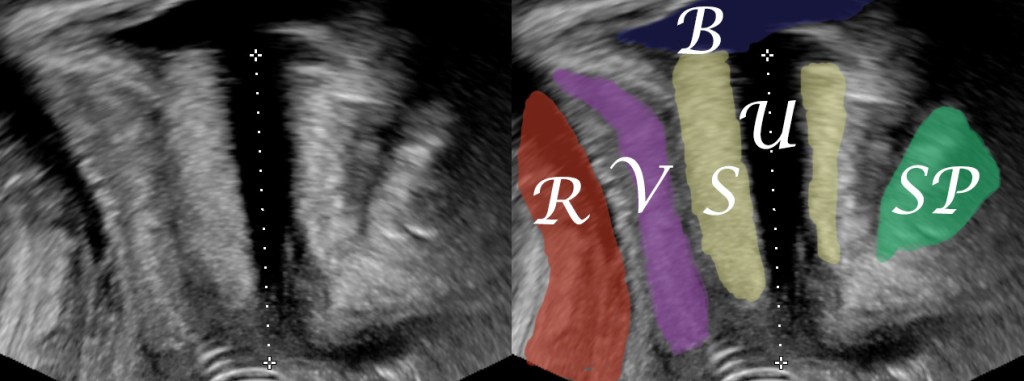 how to measure the length of the female urethra
